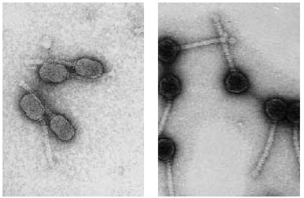 Figure 1. Scanning electron micrographs of two bacteriophage strains of mesophilic lactic acid streptococci (Lactococcus lactis) with round (isodiametric) or oblong (protruding) heads, commonly found in dairies. The band is reduced to 50 nm.